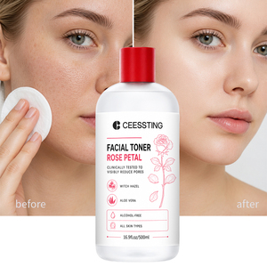 Tónico Facial Mayorista Suave para el Cuidado Diario de la Piel, Refrescante Post-Limpieza, Equilibrante e Hidratante con Pétalos de Rosa y Hamamelis - Product Image 1