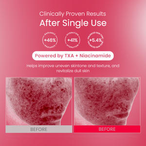 Crème hydratante TXA+Niacinamide, soin de la peau coréen, capsule d'acide tranexamique, crème pour le visage à la niacinamide - Product Image 5