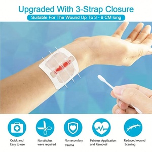 Bandes adhésives chirurgicales Zip Stitch Sutures Butterfly pour la réparation des lésions et la fermeture d'urgence des plaies - Product Image 2