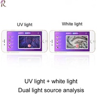 Analyseur de cuir chevelu intelligent sans fil WIFI AI, loupe portative pour salon de beauté, détection de la santé des follicules pileux