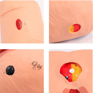 Modelo para el Cuidado <span class=keywords><strong>de</strong></span> Úlceras por Presión (escaras) - Modelo para la <span class=keywords><strong>Limpieza</strong></span> <span class=keywords><strong>de</strong></span> Escaras en Personas Mayores - Product Image 5