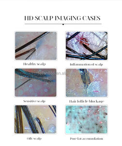 Detector avanzado de análisis de folículos pilosos con lente 50x/200x, inflamación de la piel, máquina de análisis de cabello del cuero cabelludo, dispositivo de diagnóstico de cabello - Product Image 3
