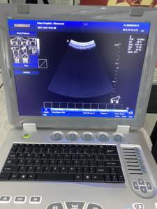 SUN-906B <span class=keywords><strong>Ultrasound</strong></span> Doppler Warna, Mesin <span class=keywords><strong>Ultrasound</strong></span> Full Digital <span class=keywords><strong>Laptop</strong></span> Obgyn <span class=keywords><strong>Ultrasound</strong></span> 3d - Product Image 6