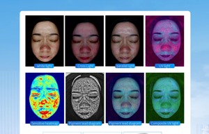 Integración DE DATOS DE PANTALLA DE 21,5 pulgadas 9 imágenes espectrales Facial AI Análisis Inteligente WIFI escáner facial analizador de piel máquina de Spa - Product Image 5