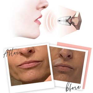 2-in-1 Mini Beauty Care Device Teeth Whitening Anti-Wrinkle Lip Plumper <b>Red</b> <b>Light</b> <b>Therapy</b> Moisturizing Electric Wrinkle Remover - Product Image 4