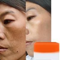 Sabun asam Kojic Lemon kunyit, pemutih kulit Natural buatan tangan mencerahkan Bar untuk perawatan tubuh wajah