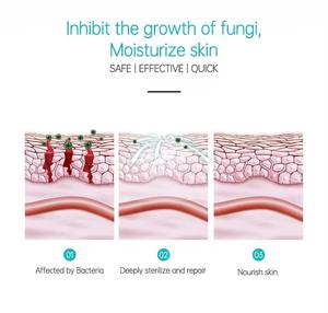 Crème pour le <span class=keywords><strong>psoriasis</strong></span> en marque privée avec des ingrédients 100% naturels, anti-démangeaisons et antifongique pour les mains, les pieds et le corps, soins de santé - Product Image 3