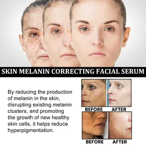 OEM siero sbiancante lentiggine riparazione macchie scure essenza dissolvenza linea del viso pelle ridurre la cura melanina rimuovere idratante