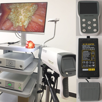 Tour d'endoscopie médicale portable FHD pour hystéroscopie et colposcopie, équipement gynécologique