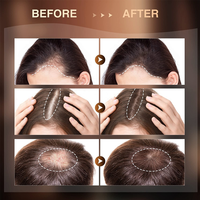 Sérum Capillaire Bio Personnalisé au Gingembre pour la Croissance des Cheveux – Huiles Capillaires Liquides Hydratantes pour Cheveux Bouclés (Hommes et Femmes) – Marque Privée