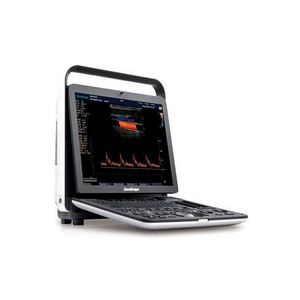 <span class=keywords><strong>Sonoscape</strong></span> S9 Hoge Resolutie Echografie Machine Ultrasonido Kleur Doppler Systeem Met Sonde - Product Image 3