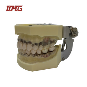 Modelo de Enfermedad Periodontal con Encía Transparente que Demuestra la Recesión Gingival para la Educación del Paciente en Clínicas Dentales - Product Image 4