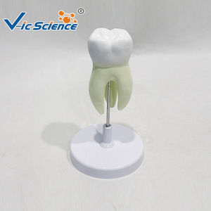 Modèle de molaires modulaire en trois parties, représentant la structure d'un dentier cariote, utilisé comme outil pédagogique et de formation en milieu scolaire - Product Image 2