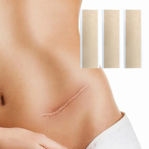 Alnlike SC0420 Patch cicatrisant en silicone hypoallergénique de qualité médicale, respectueux de la peau, réutilisable et résistant à l'eau, pour cicatrices post-chirurgicales - Product Image 1