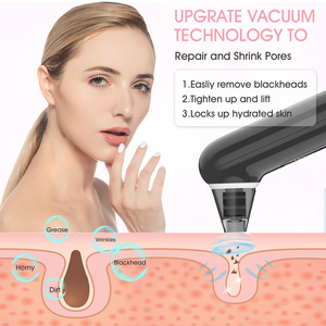 Aspirateur de pores pour nettoyage facial en profondeur, éliminateur de points noirs à l'eau pétillante, produit de beauté populaire pour usage domestique - Product Image 3