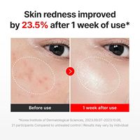 Crème Visage Hydratante et Raffermissante de Jour à la Centella Asiatica CENTELLIAN 24 Madeca, Soin Coréen Personnalisé en Gros pour OEM