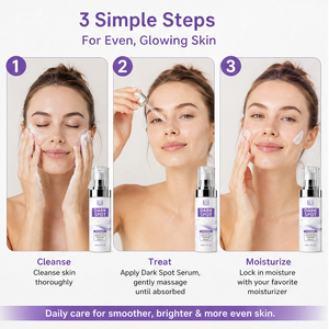 Sérum Corretor de Manchas Escuras com Niacinamida, Vitamina C, Retinol e Ácido Hialurônico, Sérum Facial Iluminador 50ml - Product Image 5
