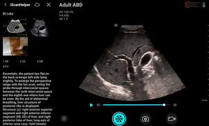 Escáner de Ultrasonido Doppler Color Veterinario Inalámbrico Wifi Mindray TE Air E5M, Portátil para Conexión con Teléfono Móvil y iPad - Product Image 5