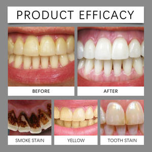 S'attaque aux taches jaunes L'accumulation de tartre revitalise l'haleine assure un dentifrice à sourire étincelant - Product Image 5