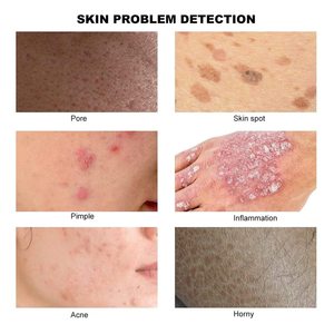 Detector de Piel y Cabello, Analizador de Cuero Cabelludo con Detección de Folículos Pilosos, Dispositivo de Belleza Multifuncional Tipo Caja con Salida USB - Product Image 4