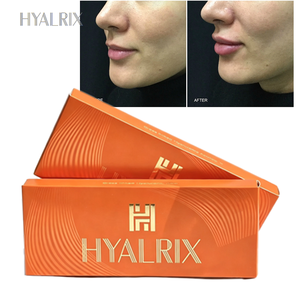 Relleno Labial de Ácido Hialurónico al por Mayor para Contorno y Volumen de <span class=keywords><strong>Labios</strong></span> 1.1mL con <span class=keywords><strong>Precio</strong></span> de Fábrica - Product Image 2