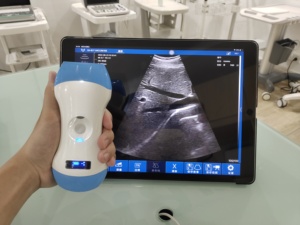 Escáner de Ultrasonido Doppler a Color 3 en 1 Inalámbrico, de Bajo Costo y Tamaño Compacto, Equipo Médico para Hospital - Product Image 6
