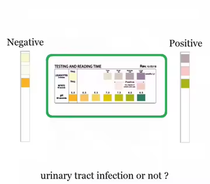 Bandelettes de test 3 en 1 pour les infections urinaires à domicile, test des leucocytes, des nitrites, du pH, kit de test des infections urinaires URS-UTI - Product Image 6