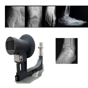 Máquina portátil da fluoroscopia do raio <span class=keywords><strong>X</strong></span> do equipamento do instrumento da fluoroscopia do raio <span class=keywords><strong>X</strong></span> de JZXR com bateria recarregável <span class=keywords><strong>X</strong></span> <span class=keywords><strong>Ray</strong></span> máquina - Product Image 4