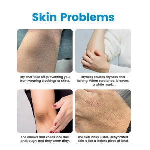 Lozione riparatrice della barriera cutanea QBEKA, crema idratante quotidiana per il corpo per pelli <span class=keywords><strong>molto</strong></span> secche e sensibili, crema per <span class=keywords><strong>viso</strong></span> e corpo - Product Image 5