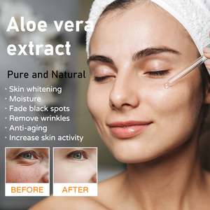 OEM 30ml verde adulto líquido cara suero té esencia niacinamida piel blanqueamiento contracción de poros efectos antienvejecimiento ACEITE DE Aloe Vera - Product Image 6