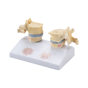 Model pengajaran medis sains medis Model Oba tulang manusia - Product Image 2