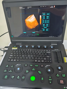 Échographe Doppler Couleur Portable de Qualité Hospitalière SN50 avec DICOM 3.0, Imagerie Harmonique des Tissus et Interface 8 Langues - Product Image 4