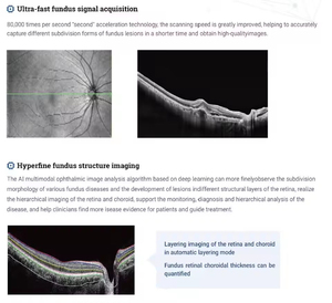 Sistema OCT Oftálmico con Análisis Avanzado de la Capa de Fibra del Nervio Retiniano, Dispositivo de Imagenología Oftálmica de Escaneo Rápido - Product Image 6