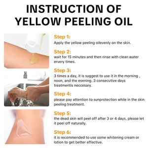 OEM/ODMプライベートラベル イエローピーリングオイル エクストラストロングフォーミュラ 傷跡除去 ストレッチマーク 美白 - Product Image 4