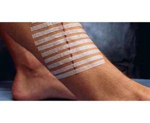 เทปกาวทางการแพทย์เย็บปราศจากเชื้อแบบใช้แล้วทิ้งเทปที่ปราศจากเชื้อมีความยืดหยุ่นดี - Product Image 4