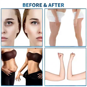 9D Roller Machine for Body Slimming & Weight Loss Anti-Cellulite Lymphatic Ball Roller - Product Image 2