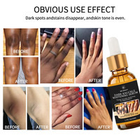 Sérum éclaircissant professionnel au curcuma pour les jointures sombres, formule de récupération cutanée intense pour le corps, marque privée