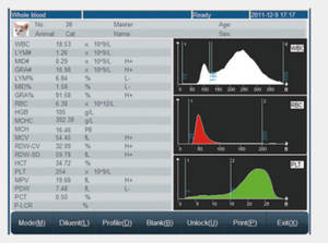 Ancel-analyseur mathématiques automatique r7600, appareil de contrôle de l'ophtalmologie, à prix coûtant, nouvelle collection - Product Image 6