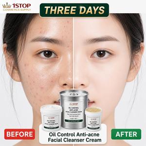 Nettoyant Moussant Aclis Doux Alcalin pour Peaux Grasses à Tendance Acnéique, Démaquillant et Anti-Points Noirs à l'Acide Salicylique - Product Image 1