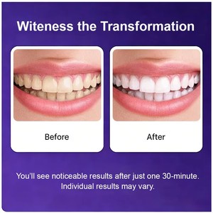Bandes blanchissantes violettes pour les dents, éliminent en douceur les taches jaunes, éclaircissent les dents, protection non sensible, menthe, patchs blanchissants pour les dents - Product Image 6