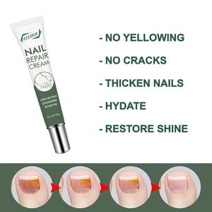 Crema Reparadora de Uñas con Extracto Herbal, Crema de Belleza para Uñas Brillantes, Tratamiento Antifúngico para Uñas de los Pies - Product Image 5