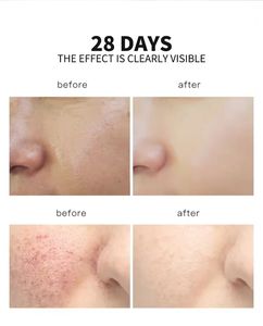 OEM Serum Vitamin C 5 in 1, dengan Retinol Niacinamide Anti Penuaan wajah pencerah untuk semua jenis kulit - Product Image 3