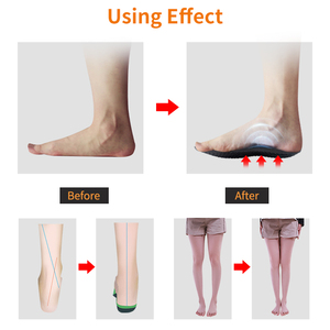 Hakainas-Chanclas de arco con soporte, chanclas ortopédicas, el mejor precio - Product Image 4