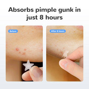 가장 인기 있는 스타 여드름 패치 장식용 하이드로콜로이드 강력한 점액 흡입 소매 도매 51개 패치 - Product Image 5