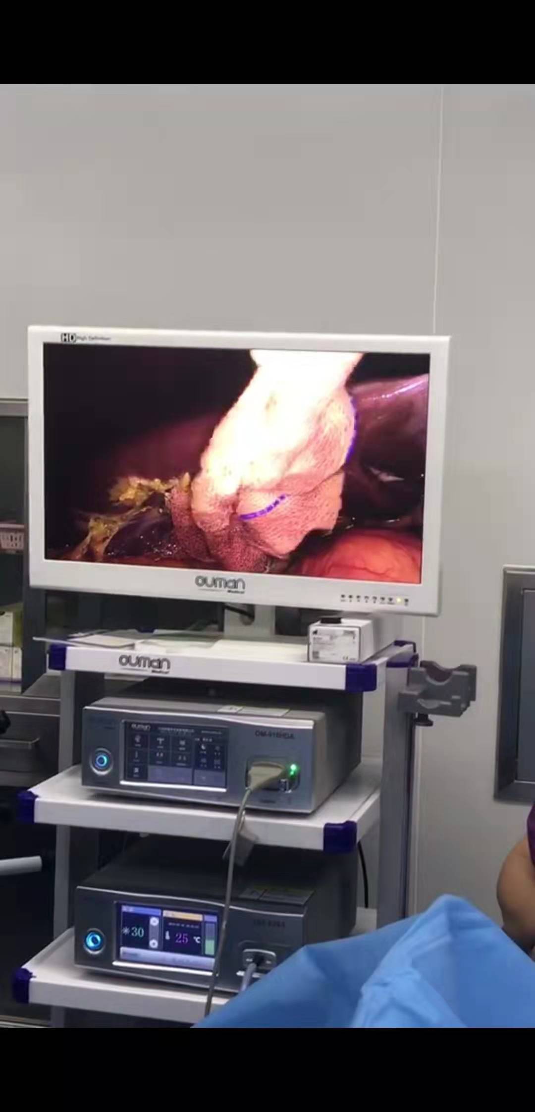 OM-TCD Metal Medical Workstation Cart split type 