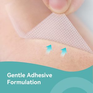 Bán buôn y tế dễ dàng xé không thấm nước Silicone micropore dính trong suốt phẫu thuật PE Băng vật tư y tế - Product Image 5