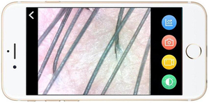 Sistema de análisis de piel <span class=keywords><strong>digital</strong></span> de 8 espectros con escáner facial AI de informes en la nube para aplicaciones comerciales de salón de casa - Product Image 6