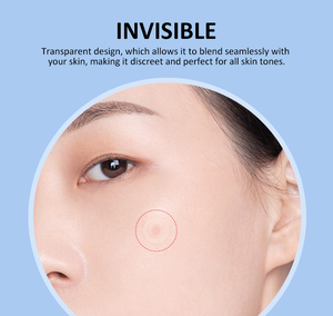 Cerotti Antiprurito, Patch per Punture di Insetti, Zanzare, Zecche, Moscerini, Mosche della Sabbia e Cimici - Product Image 6