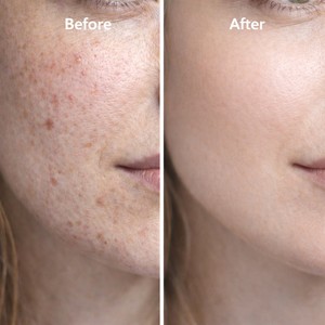 Suero Facial Vegano de Marca Privada con Ácido Hialurónico, Reafirmante de la Piel, Reductor de Líneas Finas, 100% Puro Péptido de Cobre Azul - Product Image 4