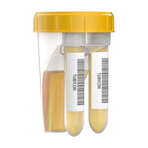 Conteneur à échantillons non stérile à double compartiment pour urine, sans aiguille, avec tubes détachables (2 unités) pour transfert d'échantillons simultané et scellé - Product Image 3